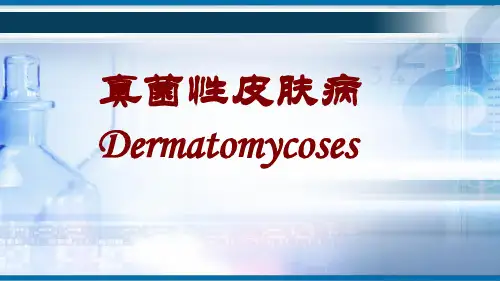 真菌性皮肤病——理论知识讲解