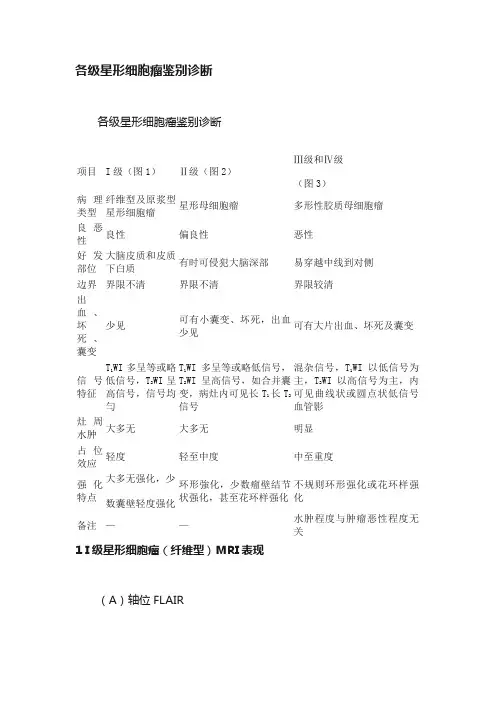各级星形细胞瘤鉴别诊断