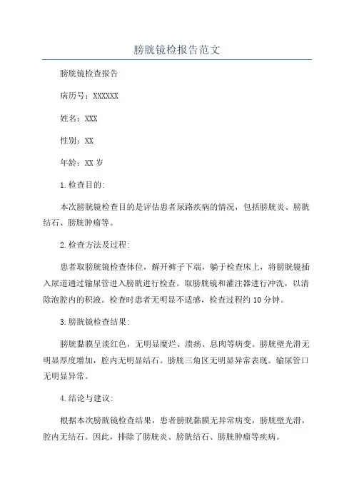 膀胱镜检报告范文