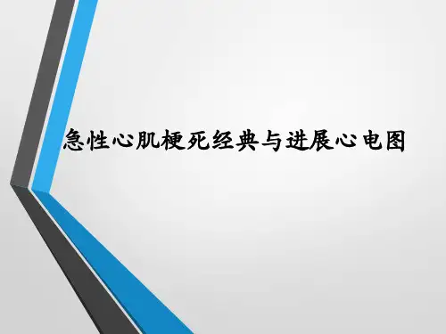 临床心电图-急性心肌梗死经典与进展心电图!