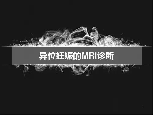 (医学课件)内耳畸形CT