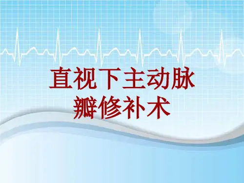 手术讲解模板：直视下主动脉瓣修补术