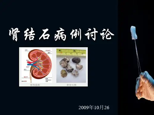 肾结石病例讨论PPT课件