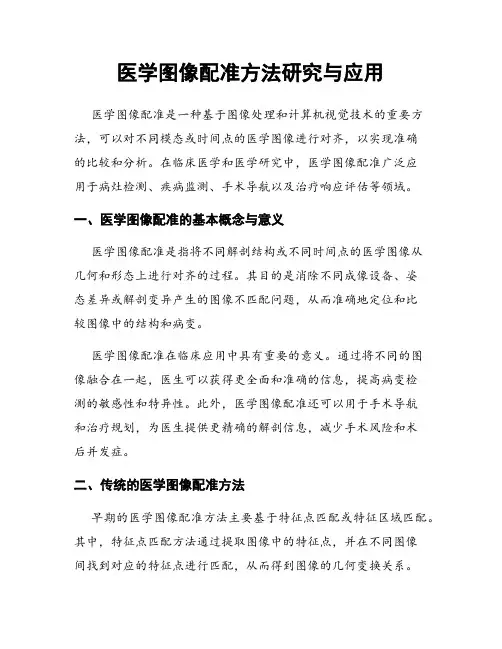 医学图像配准方法研究与应用