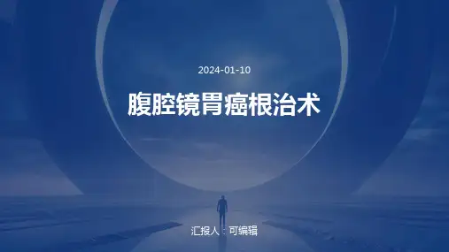 腹腔镜胃癌根治术