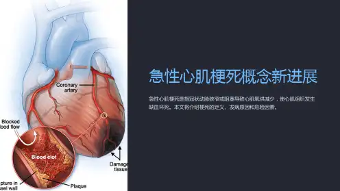 急性心肌梗死概念新进展