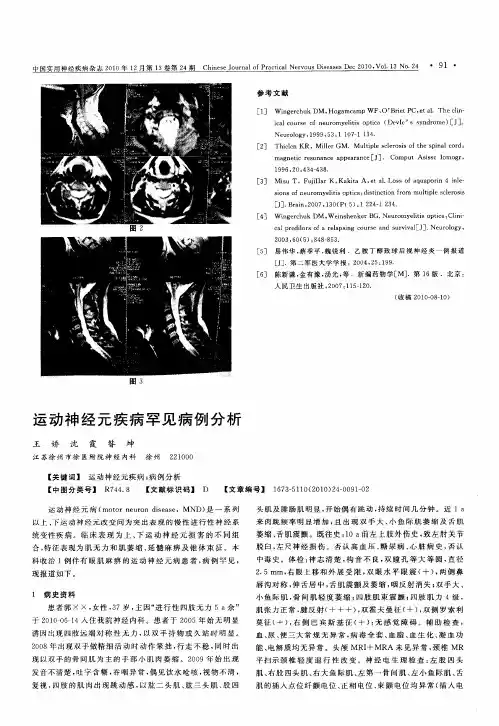 运动神经元疾病罕见病例分析