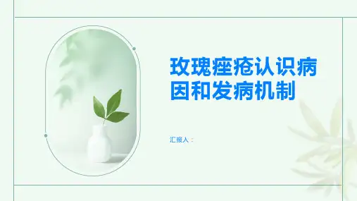 玫瑰痤疮认识病因和发病机制