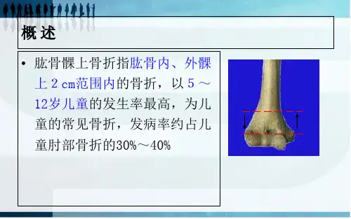 优质PPT课件精选肱骨髁上骨折