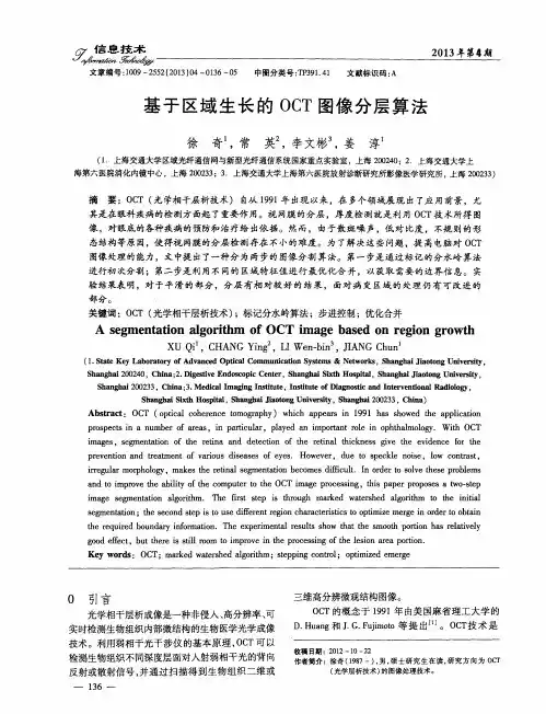 基于区域生长的OCT图像分层算法