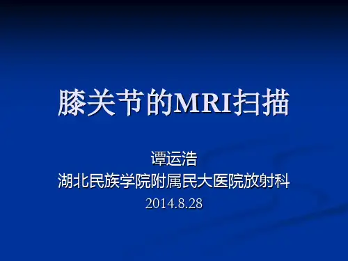 膝关节mri扫描技术 ppt课件
