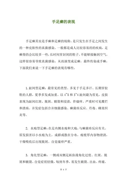 手足癣的表现
