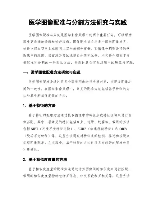 医学图像配准与分割方法研究与实践