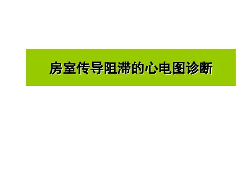 房室阻滞部位的心电图诊断