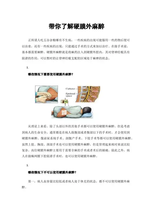 带你了解硬膜外麻醉