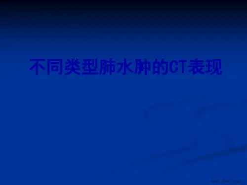 不同类型的肺水肿CT表现及鉴别诊断
