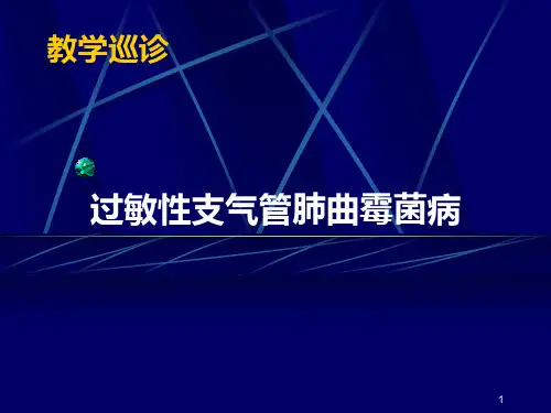 北京协和医院  ABPA教学PPT课件