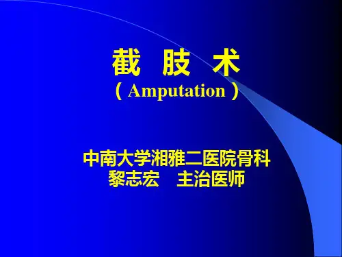 截肢术
