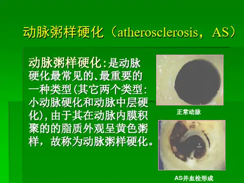 冠心病稳定型心绞痛幻灯片