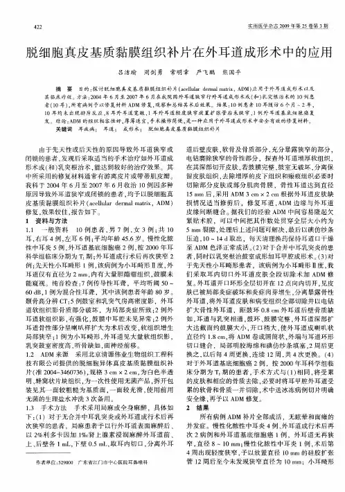 脱细胞真皮基质黏膜组织补片在外耳道成形术中的应用