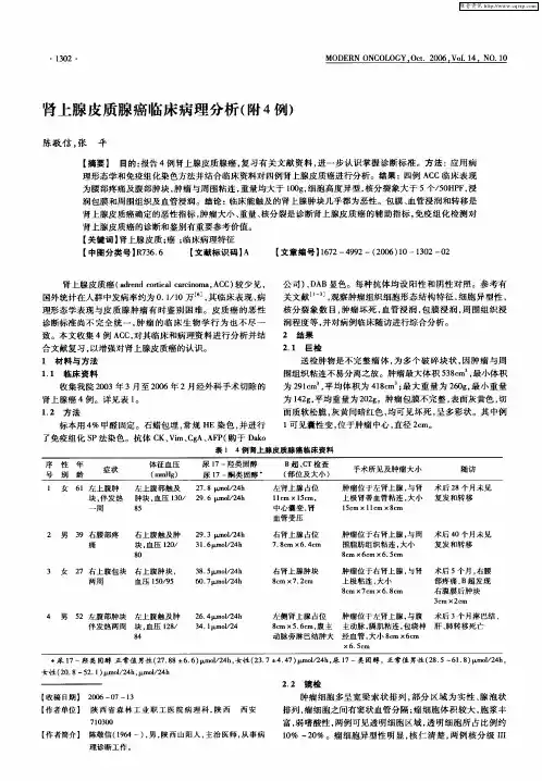 肾上腺皮质腺癌临床病理分析(附4例)