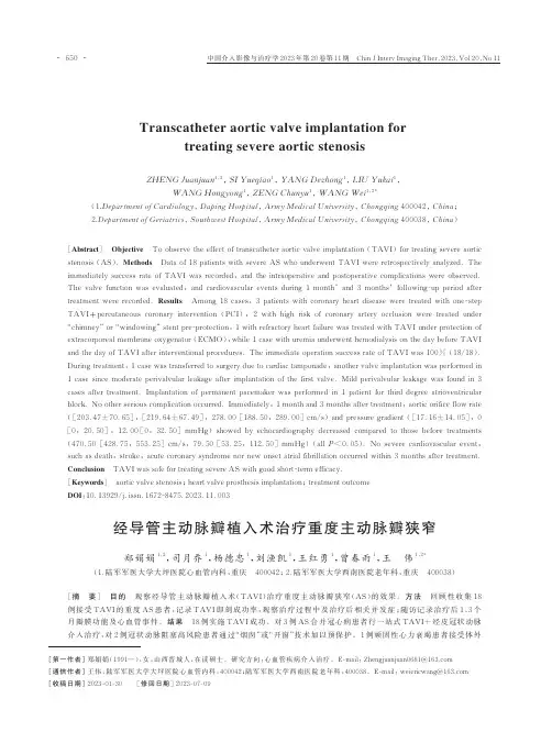 经导管主动脉瓣植入术治疗重度主动脉瓣狭窄