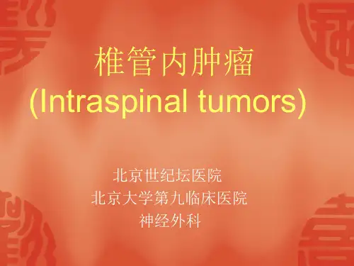 椎管内肿瘤