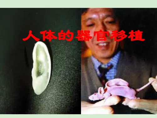 高中生物 1.3《人体的器官移植》课件1 新人教版选修2
