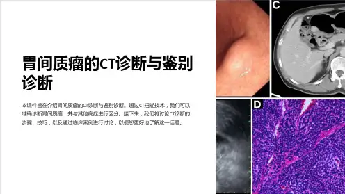 胃间质瘤的ct诊断与鉴别诊断课件