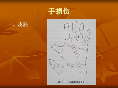 手外伤ppt课件