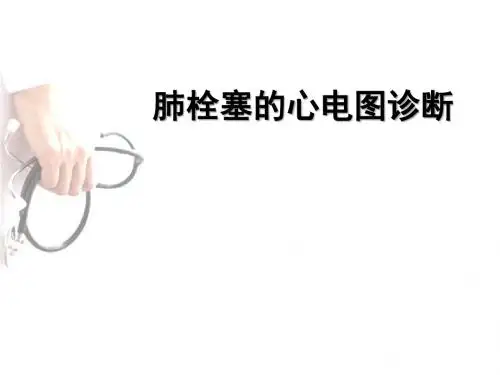肺栓塞的心电图诊断ppt课件