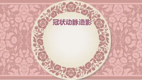 冠脉造影ppt课件