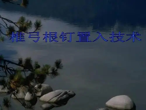椎弓根钉置入技术讲座