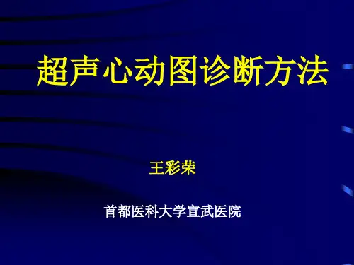 超声心动图