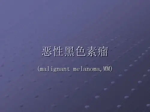 恶性黑色素瘤ppt课件