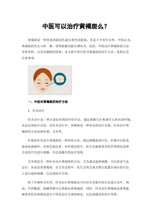 中医可以治疗黄褐斑么？