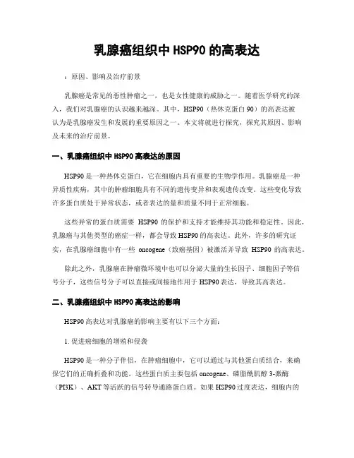 乳腺癌组织中HSP90的高表达
