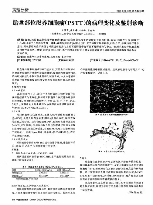 胎盘部位滋养细胞瘤(PSTT)的病理变化及鉴别诊断