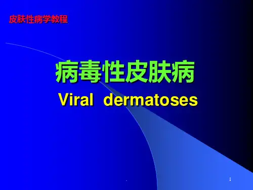 病毒性皮肤病