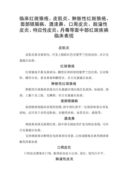 临床红斑狼疮、皮肌炎面部银屑病、口周皮炎、脱溢性皮炎、特应性皮炎、丹毒等面中部红斑疾病临床特征表现