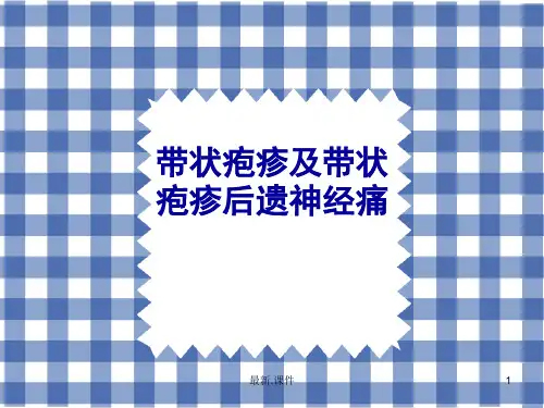 带状疱疹及带状疱疹后神经痛全面.ppt