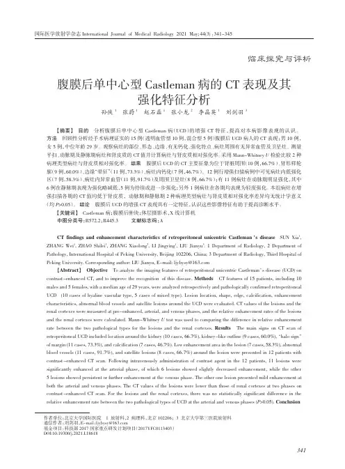 腹膜后单中心型Castleman病的CT表现及其强化特征分析