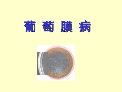 眼科学-葡萄膜病(五官)
