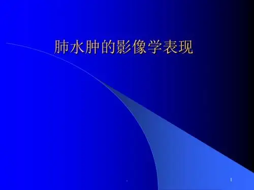肺水肿的影像学表现ppt课件