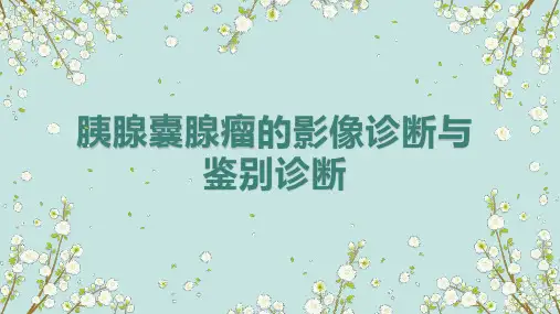 胰腺囊腺瘤的影像诊断与鉴别诊断