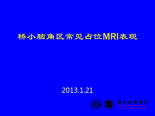 桥小脑角区常见占位MRI表现