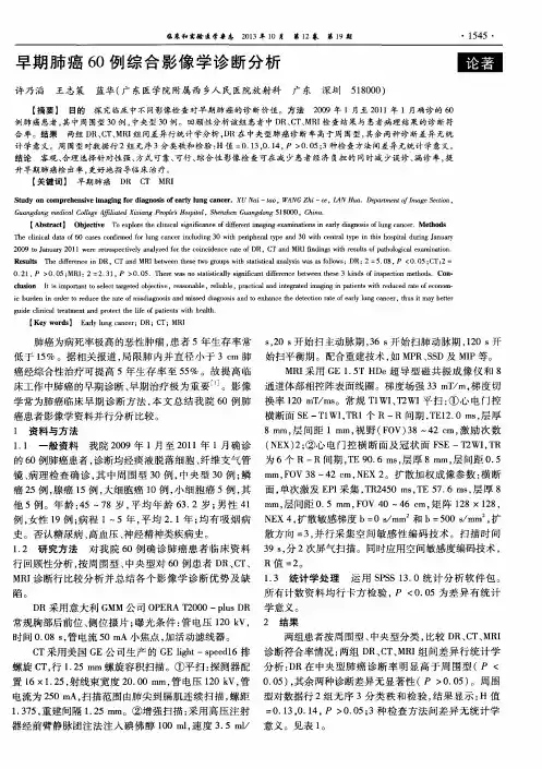 早期肺癌60例综合影像学诊断分析