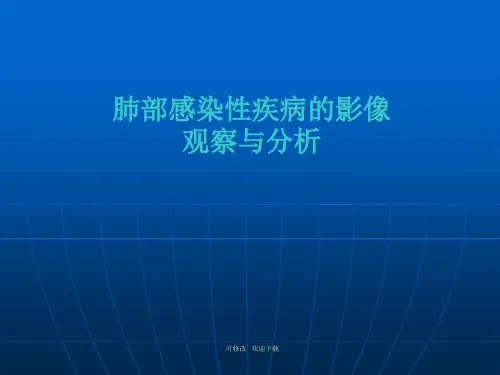 肺部感染性疾病的影像观察与分析精品课件
