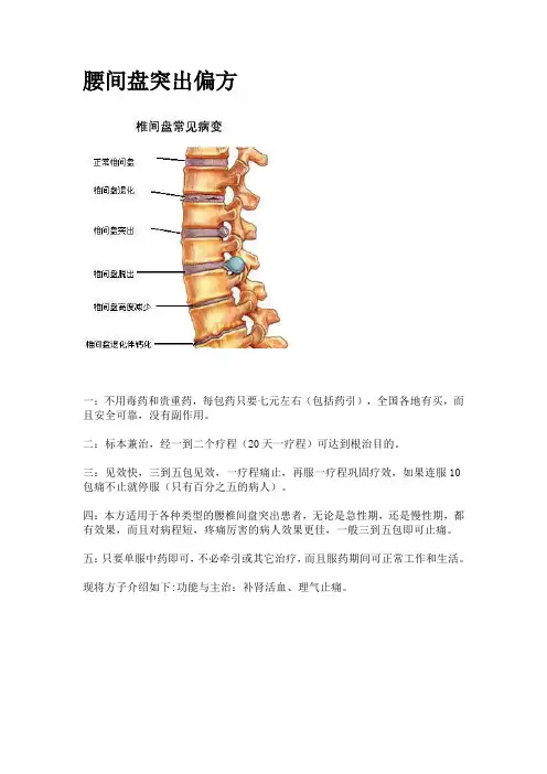 腰间盘突出偏方