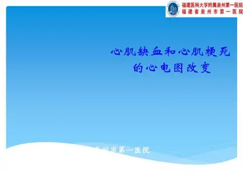 心肌缺血与心肌梗死心电图改变ppt课件